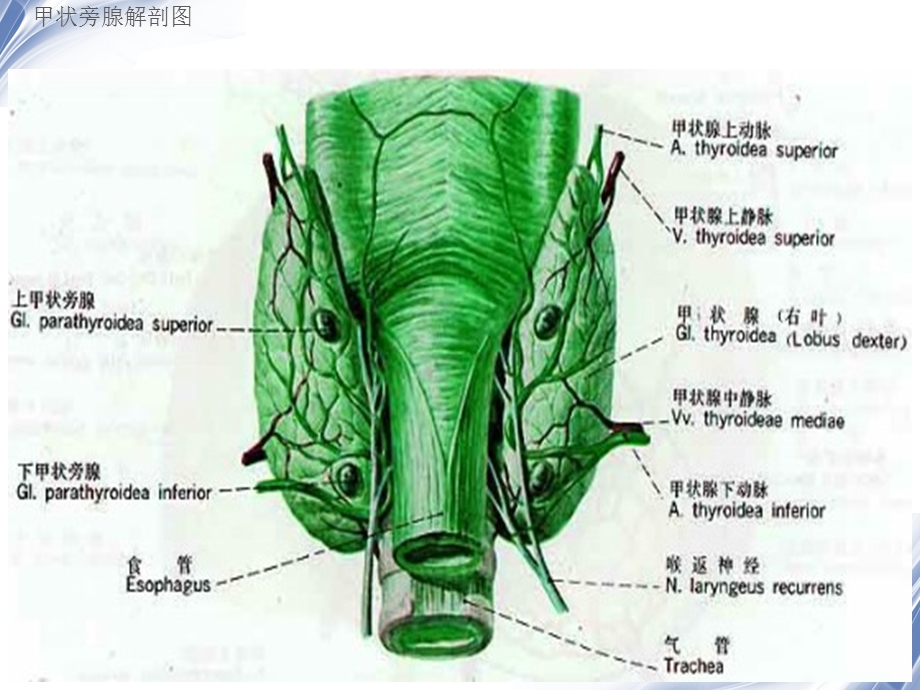 医学影像-甲状旁腺功能亢进性棕色瘤.ppt_第3页