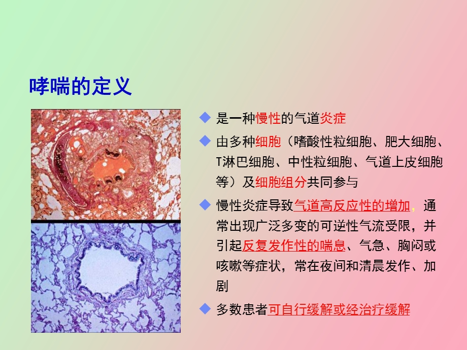 吸入糖皮质激素在哮喘治疗中的地位与应用.ppt_第2页