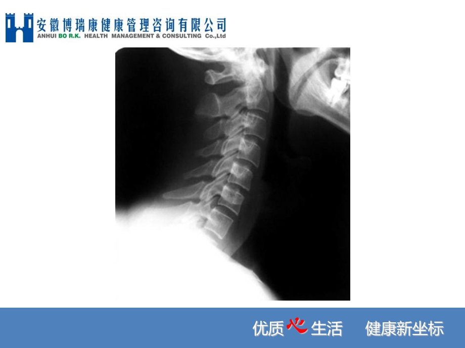 办公室一族常见病预防.ppt_第3页