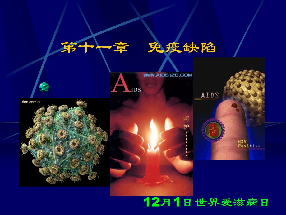 第十一章免疫缺陷.ppt_第1页