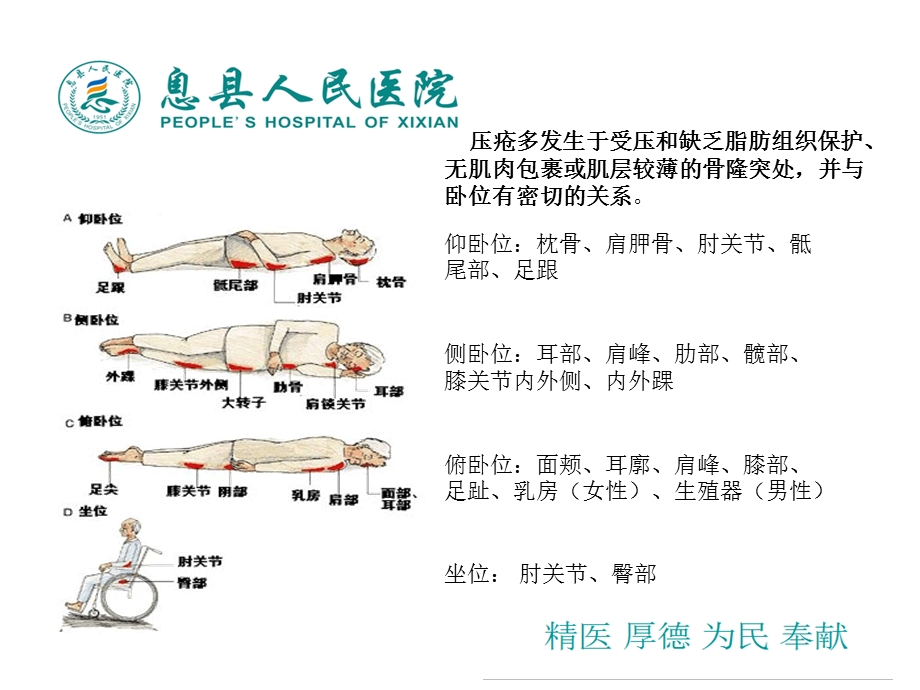 压疮的诊断和护理.ppt_第3页