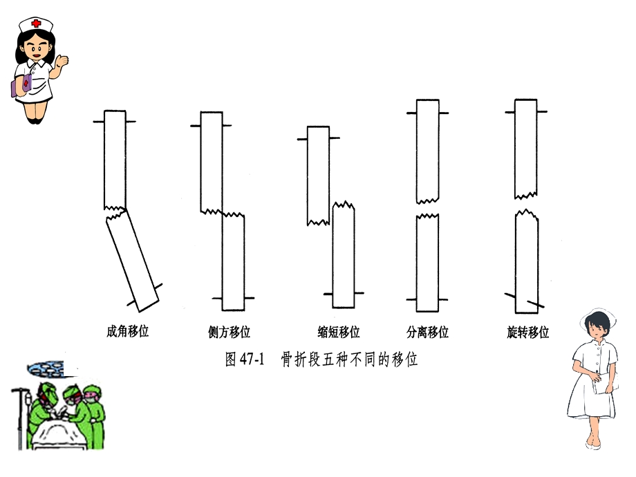 第四十七章骨与关节损伤病人的护理.ppt_第2页