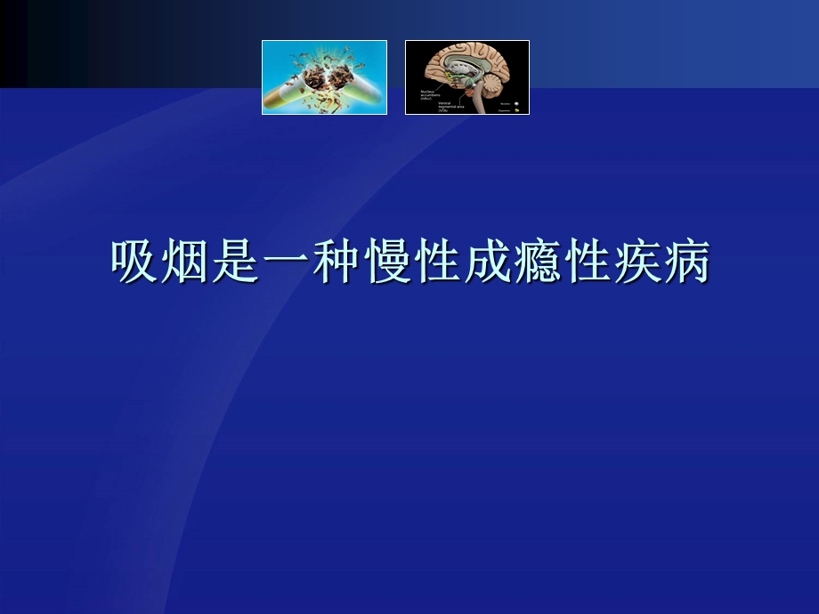 吸烟是一种慢性成瘾性疾病.ppt_第1页