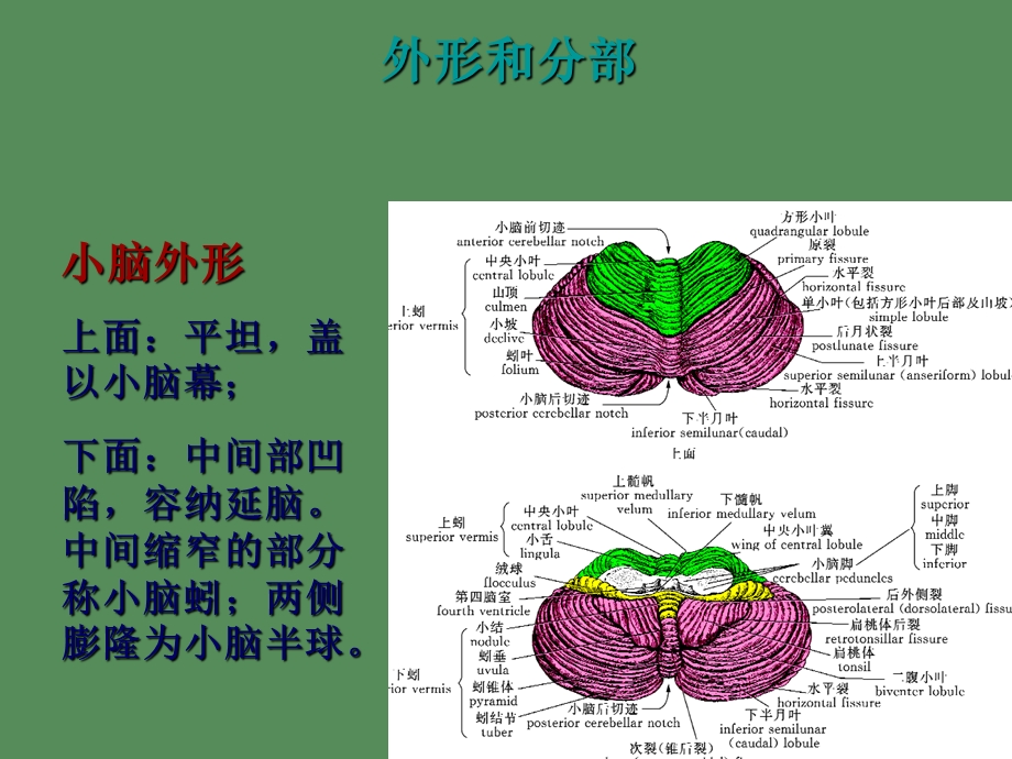 小脑出血诊疗规范.ppt_第3页