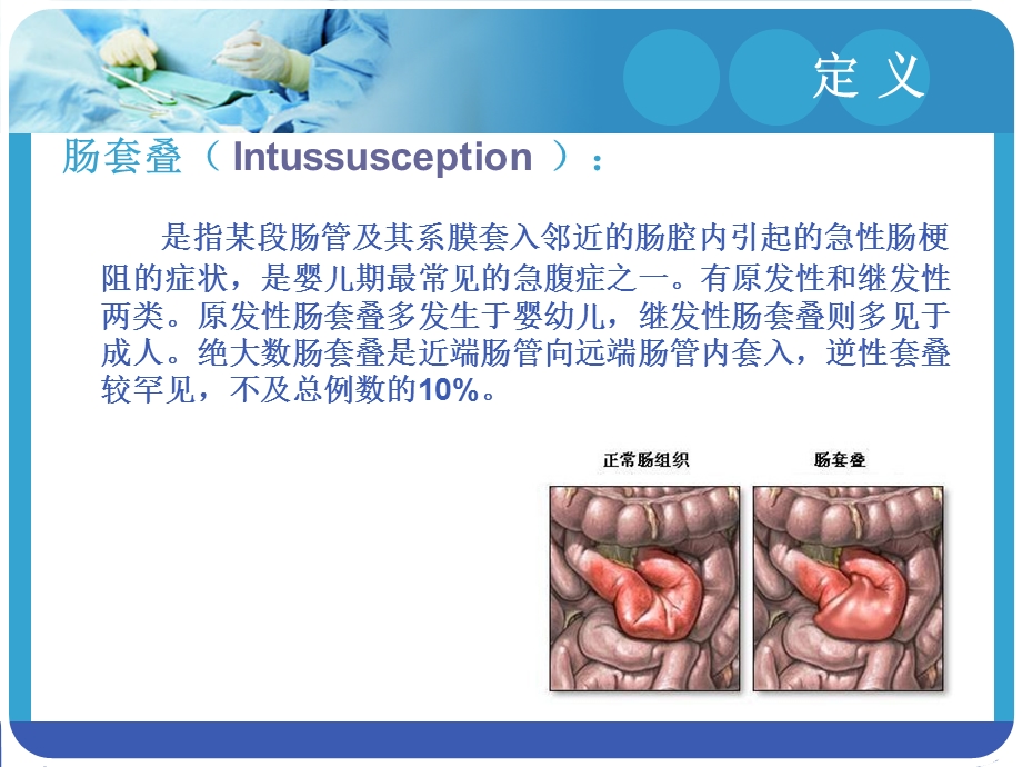 小儿肠套叠-课件.ppt_第3页