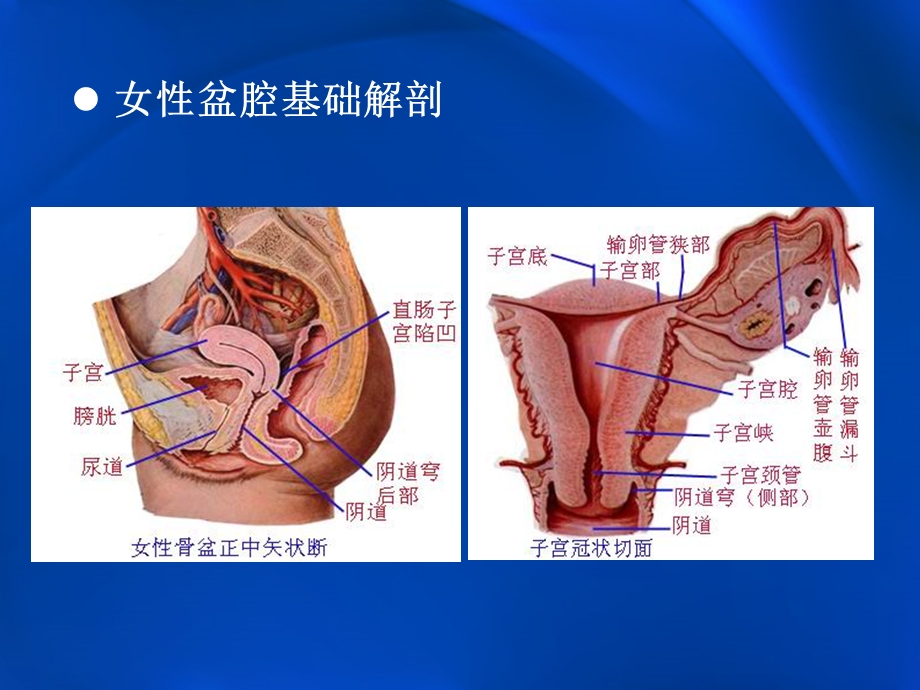 子宫内膜癌的MRI评价.ppt_第2页