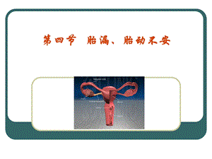 第四胎漏胎动不安.ppt