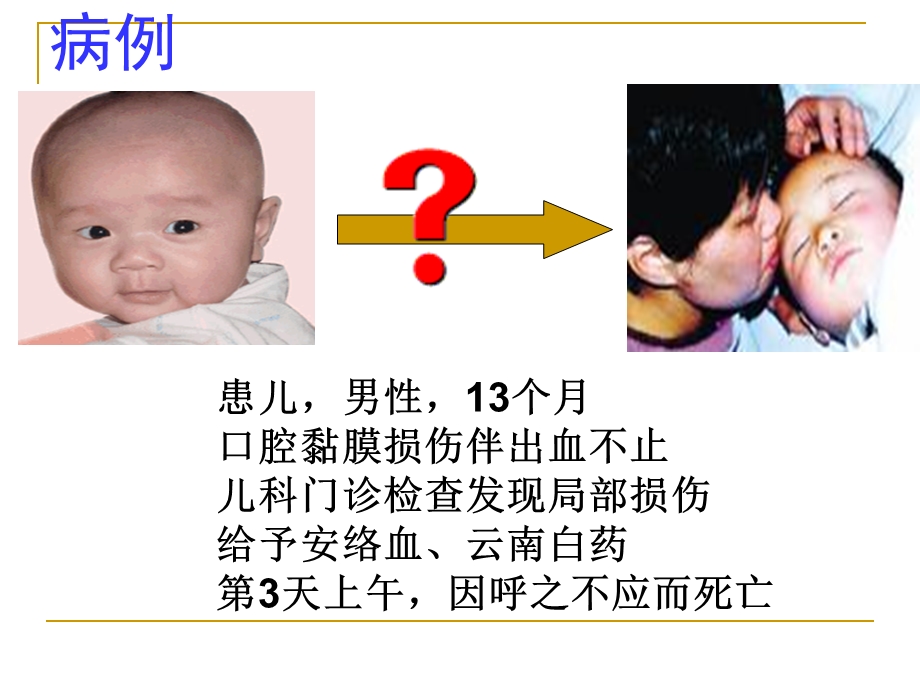 第四节出血性疾病病人的护理.ppt_第2页