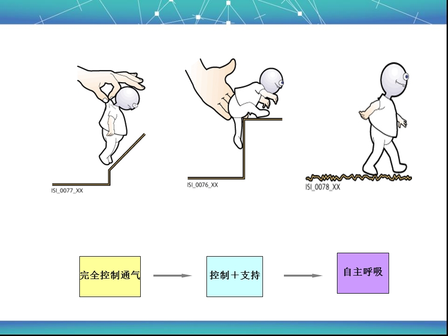 小儿呼吸机相关知识详解.ppt_第3页