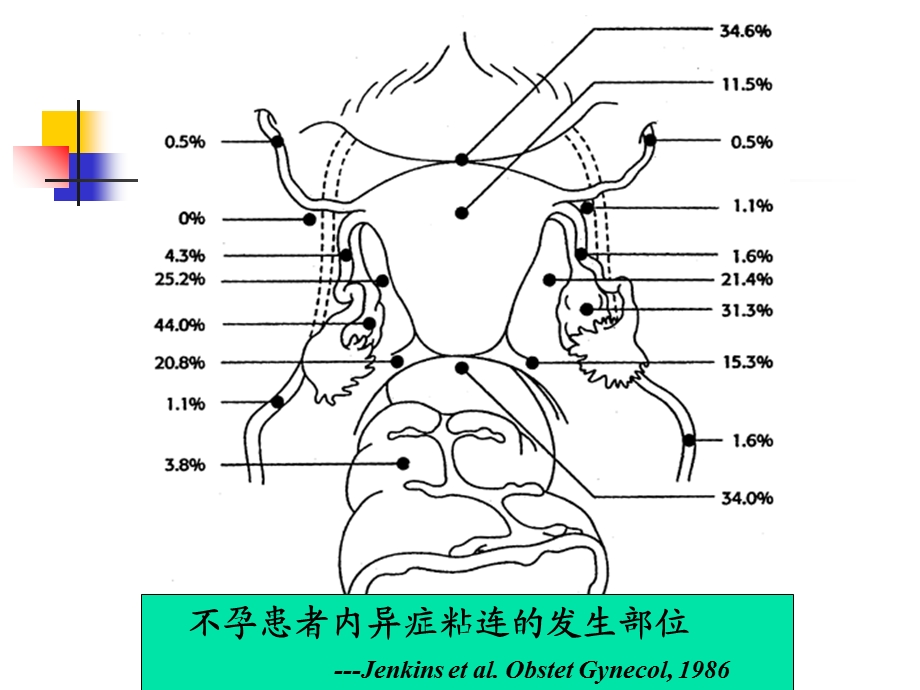 子宫内膜异位症与不育-田秦杰.ppt_第3页