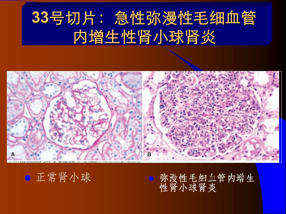 温州医科大学病理学实验考7ppt课件.ppt_第1页