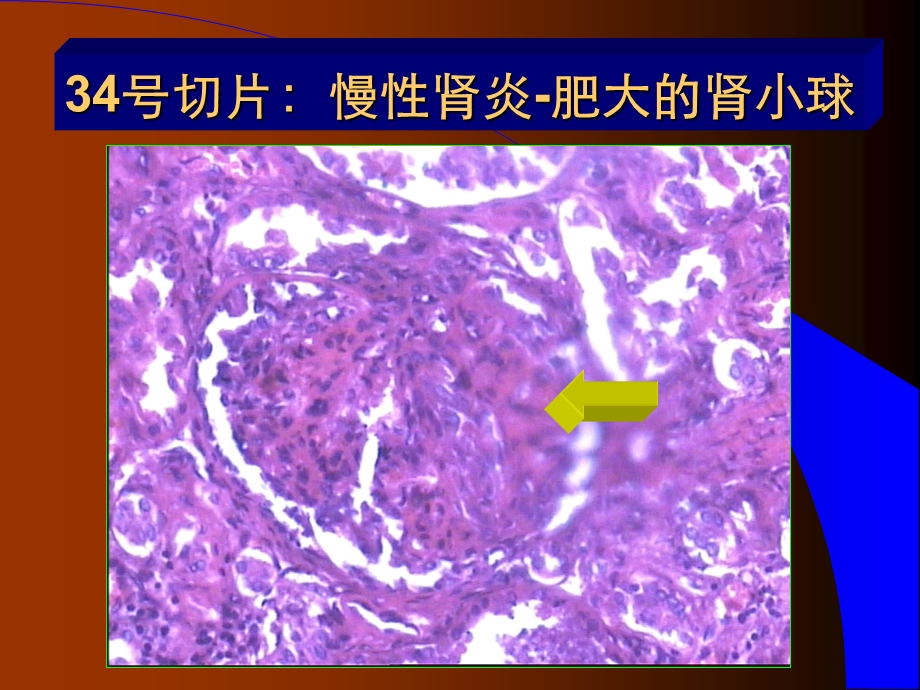 温州医科大学病理学实验考7ppt课件.ppt_第3页