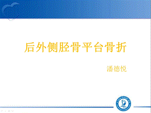 后外侧胫骨平台骨折.ppt