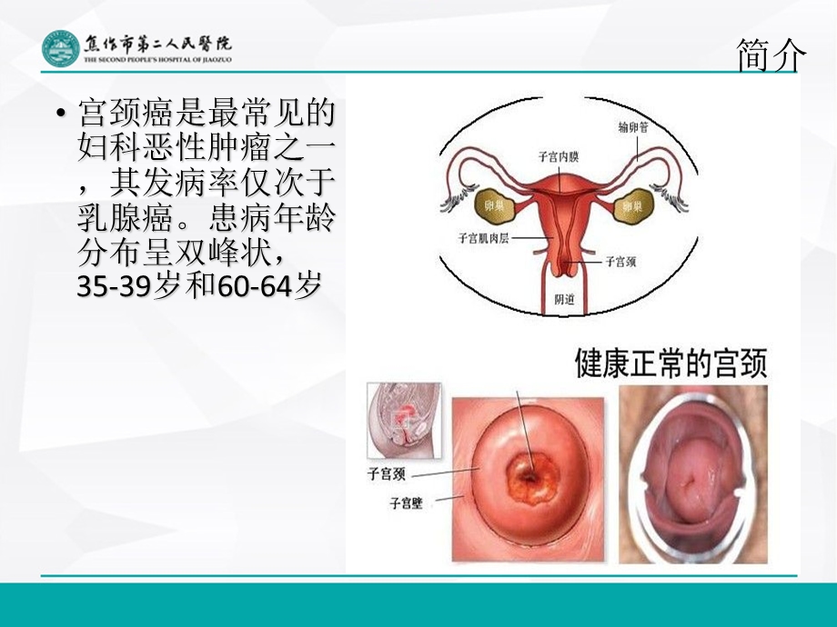 宫颈癌手术配合及注意事项.ppt_第3页