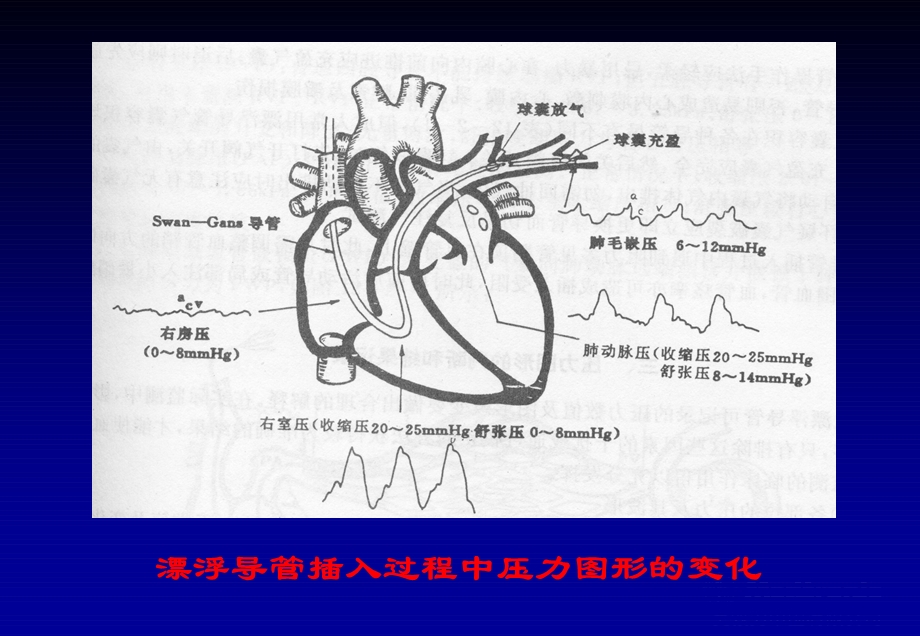 心脏介入治疗ppt课件.ppt_第2页