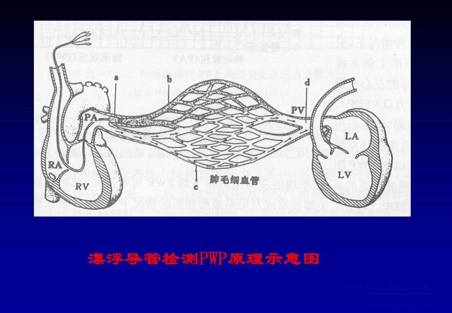 心脏介入治疗ppt课件.ppt_第3页