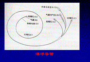 心脏介入治疗ppt课件.ppt