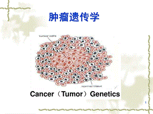 医学遗传学肿瘤遗传学ppt课件.ppt