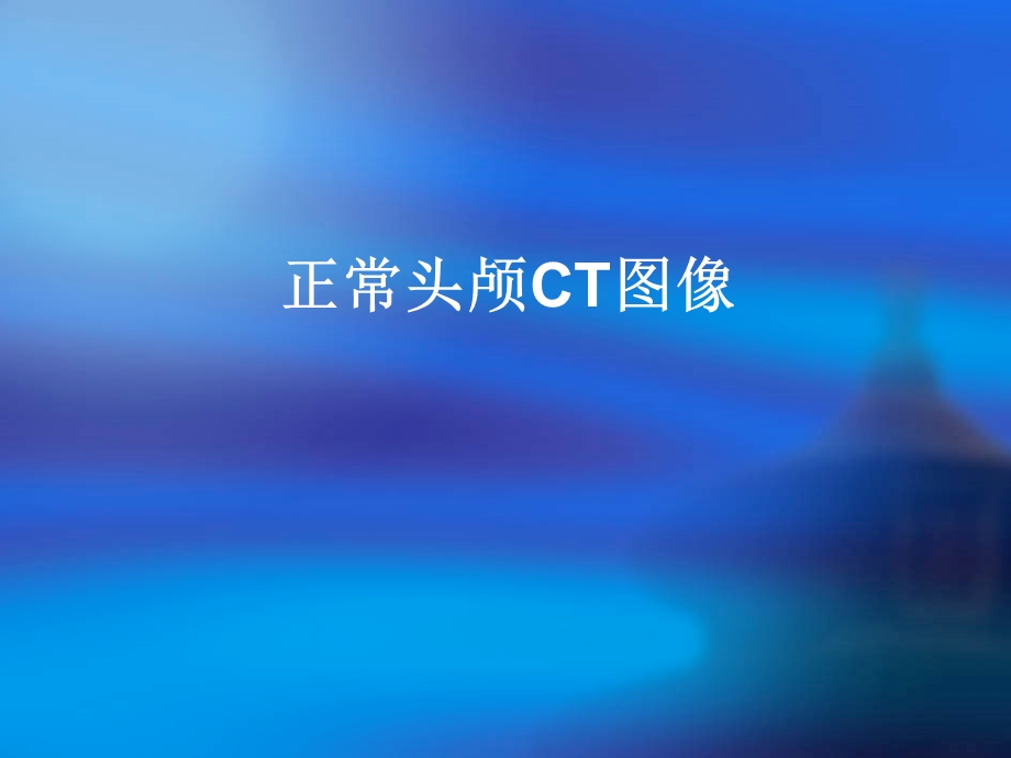 脑血管病示教不怕怕.ppt_第2页