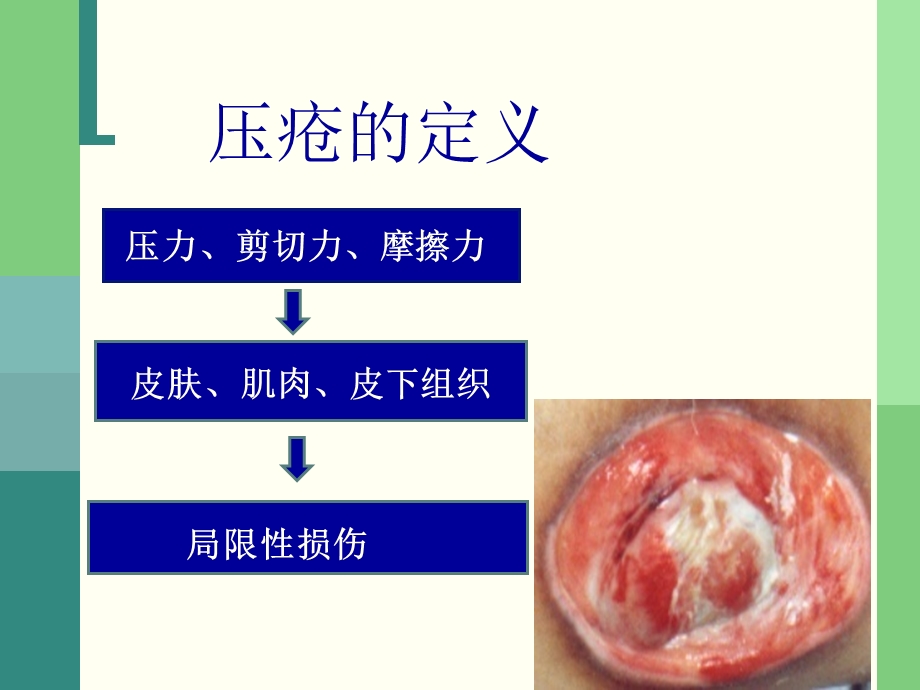 压疮危险因素及评估.ppt_第3页