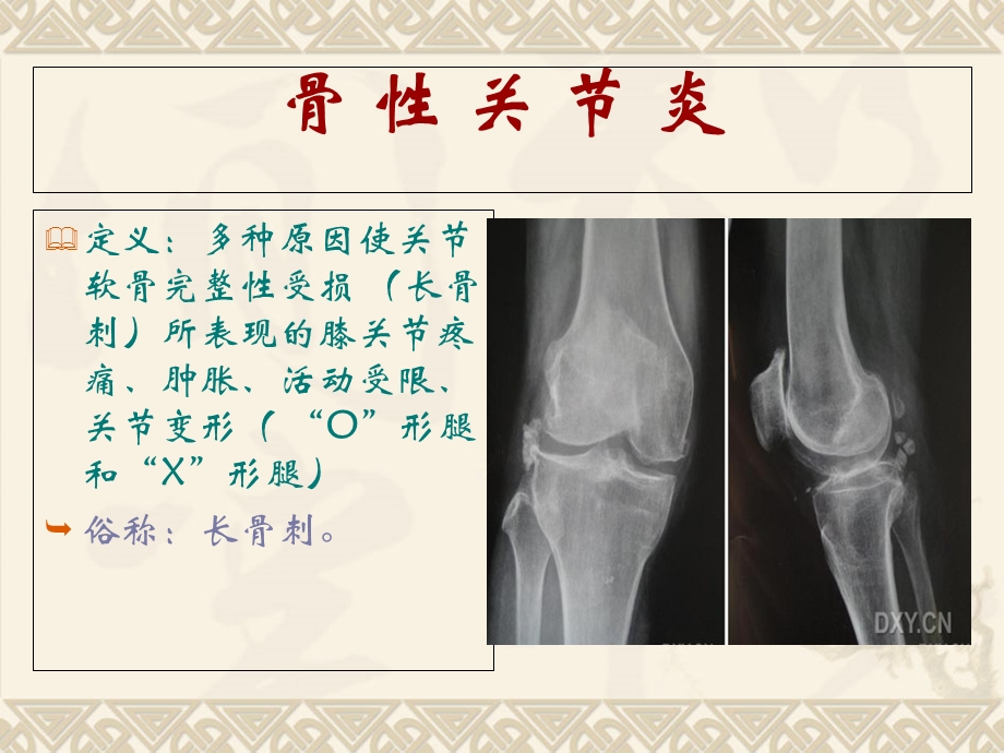 健康知识讲座膝关节.ppt_第2页