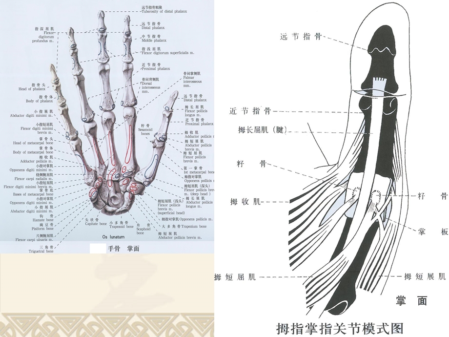 屈指肌狭窄性腱鞘炎.ppt_第3页