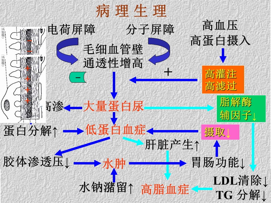 原发性肾病综合征的诊治.ppt_第3页