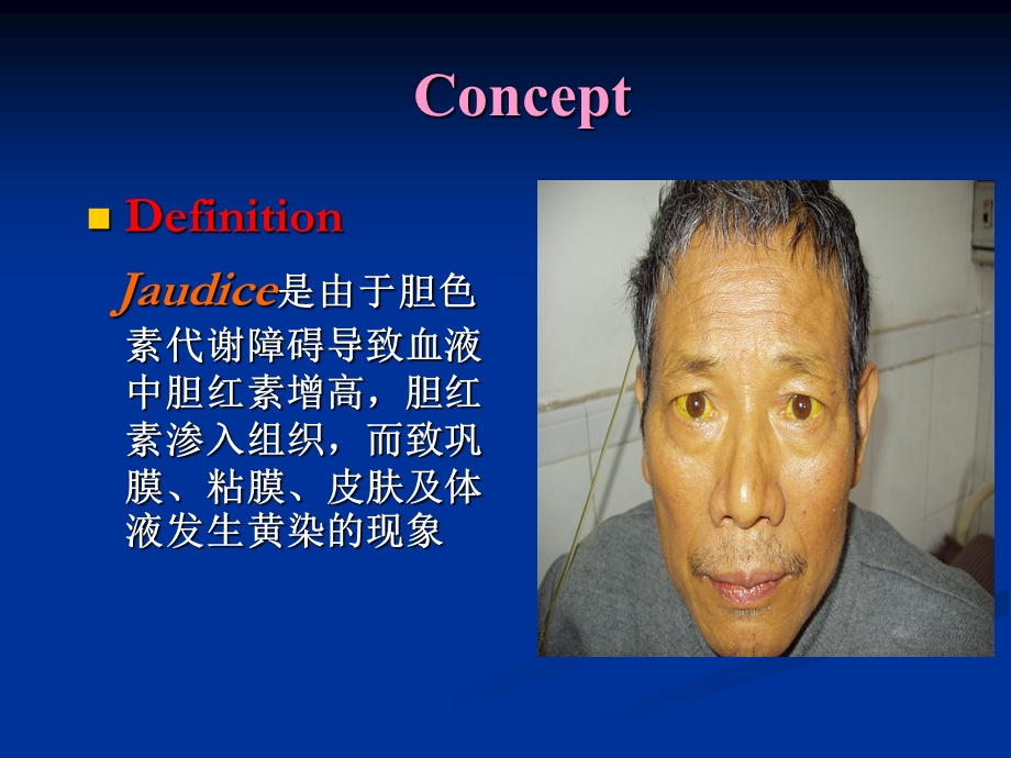 第十六黄疸Jaundice临床技能实验室刘晋.ppt_第3页