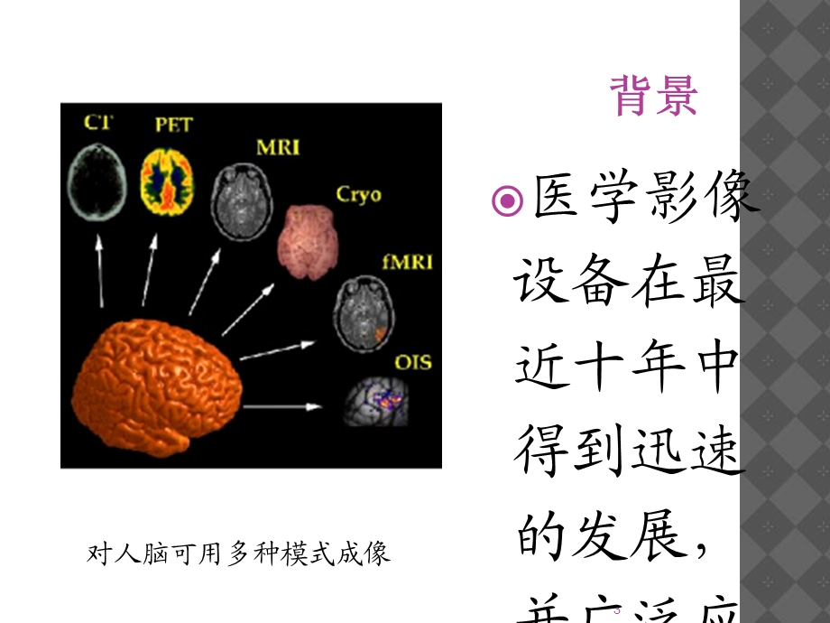 医学图像配准和融合.ppt_第3页