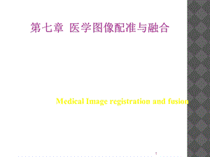 医学图像配准和融合.ppt