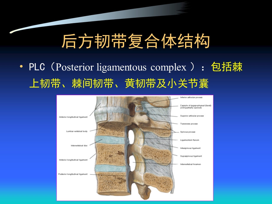 后方韧带复合体损伤的诊断及其临床意义.ppt_第2页