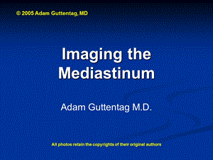 医学pptmediastinummodadam.ppt