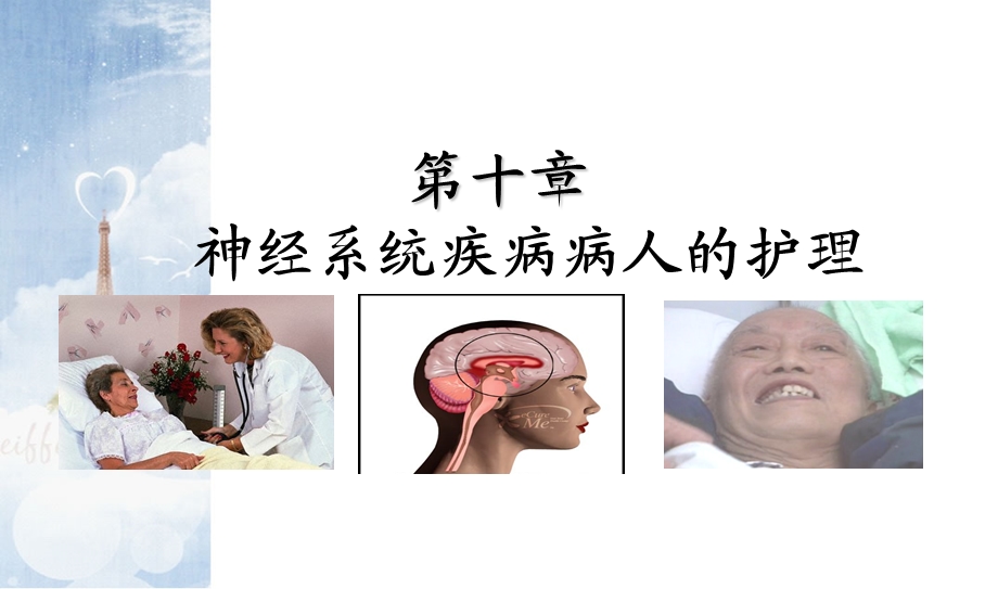 脑出血的护理.ppt_第1页