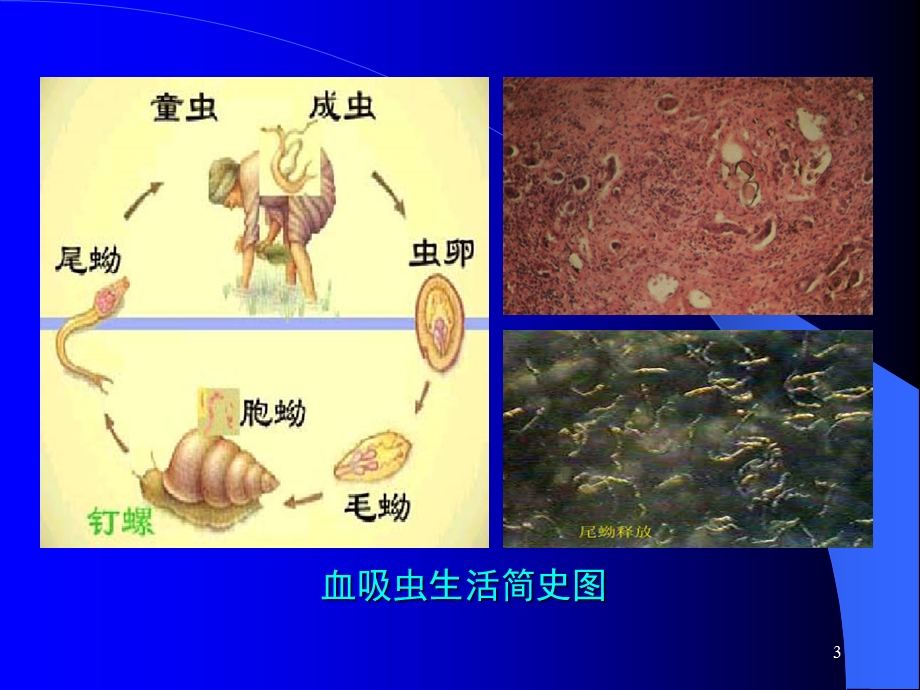 第三章 第7节食源性寄生虫及危害.ppt_第3页