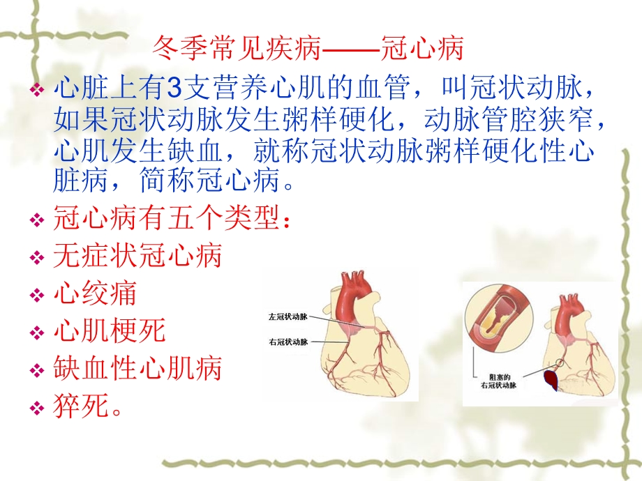 冬季中老年人常见疾病预防及保健.ppt_第3页