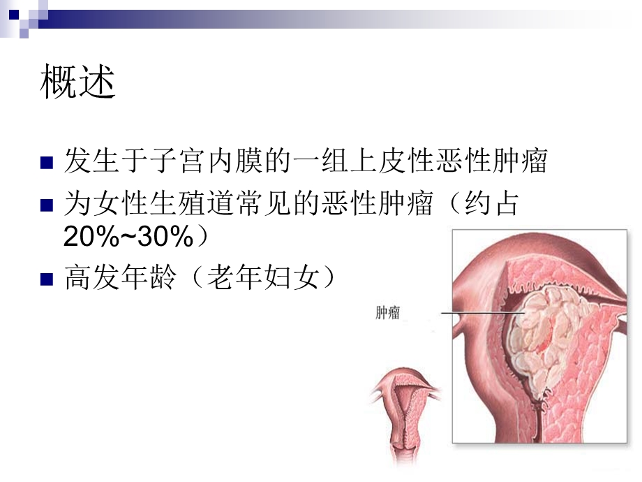 子宫内膜癌合并糖尿病围手术期.ppt_第3页