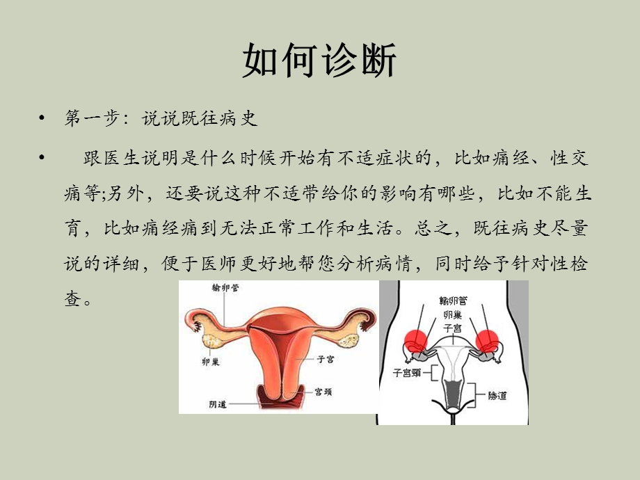 子宫内膜异位症诊断.ppt_第3页