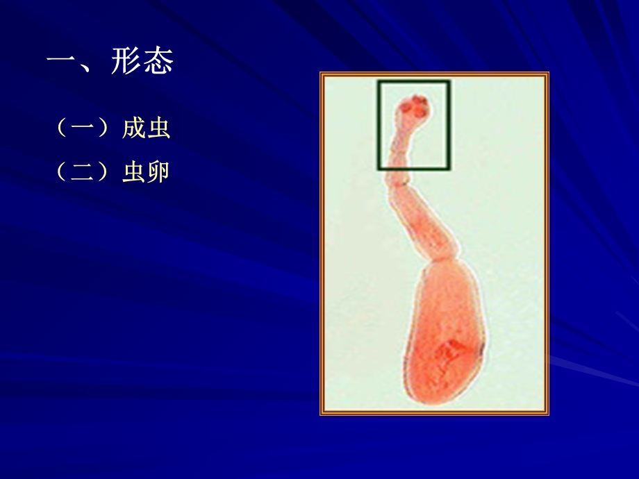 医学寄生虫学394细粒棘球绦虫.ppt_第3页