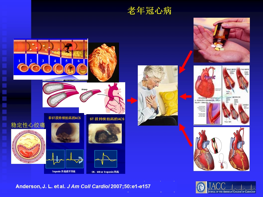 老年冠心病患者心脏康复治疗的基本概念.ppt_第2页