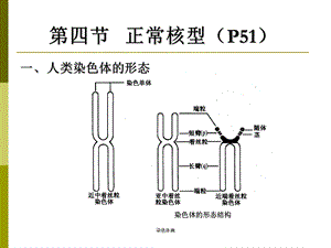 医学遗传学-染色体病ppt课件.ppt