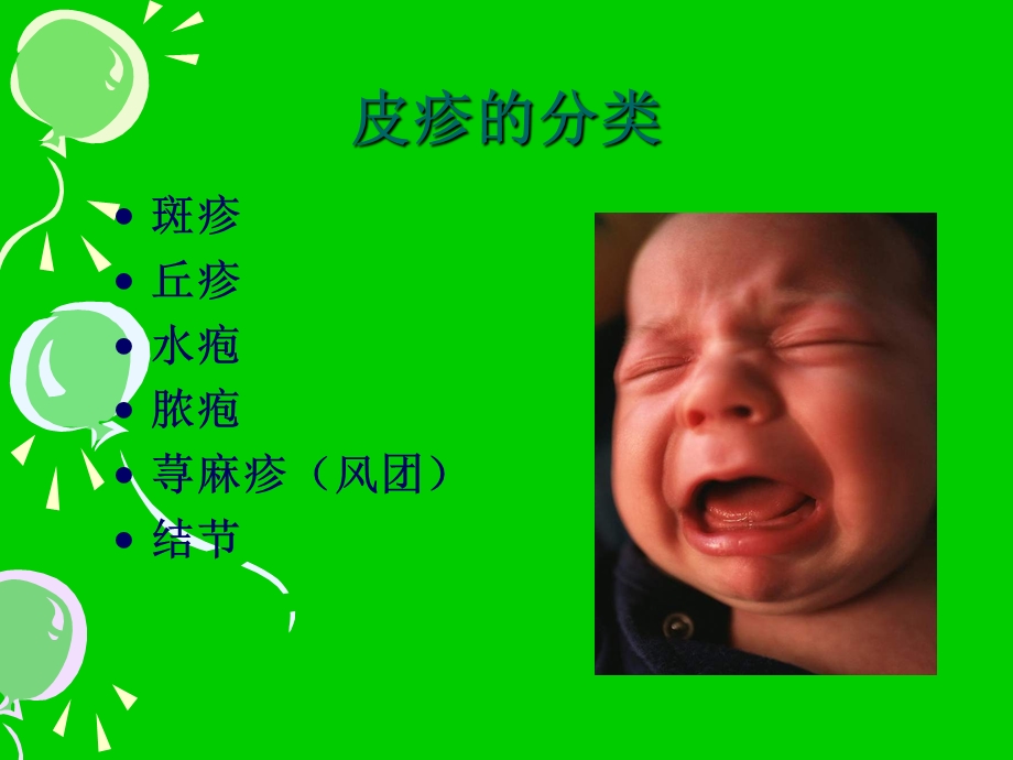 小儿皮疹鉴别与诊.ppt_第3页