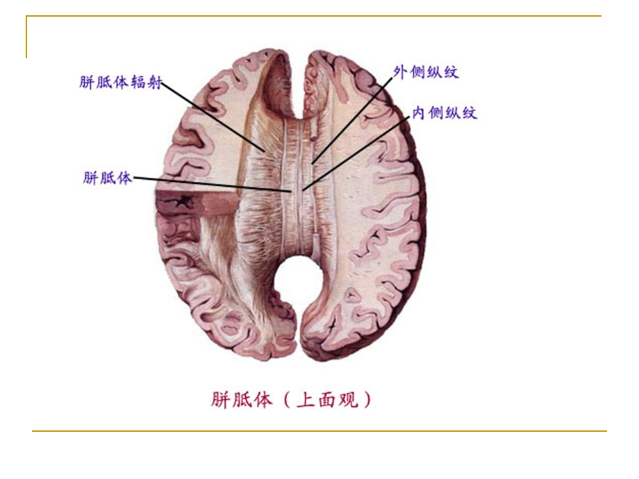 胼胝体常见病变大全.ppt_第3页