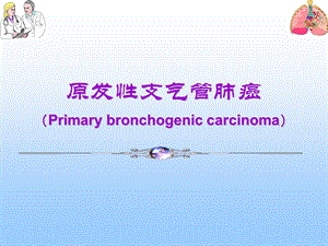 原发性支气管肺癌PPT课件.ppt