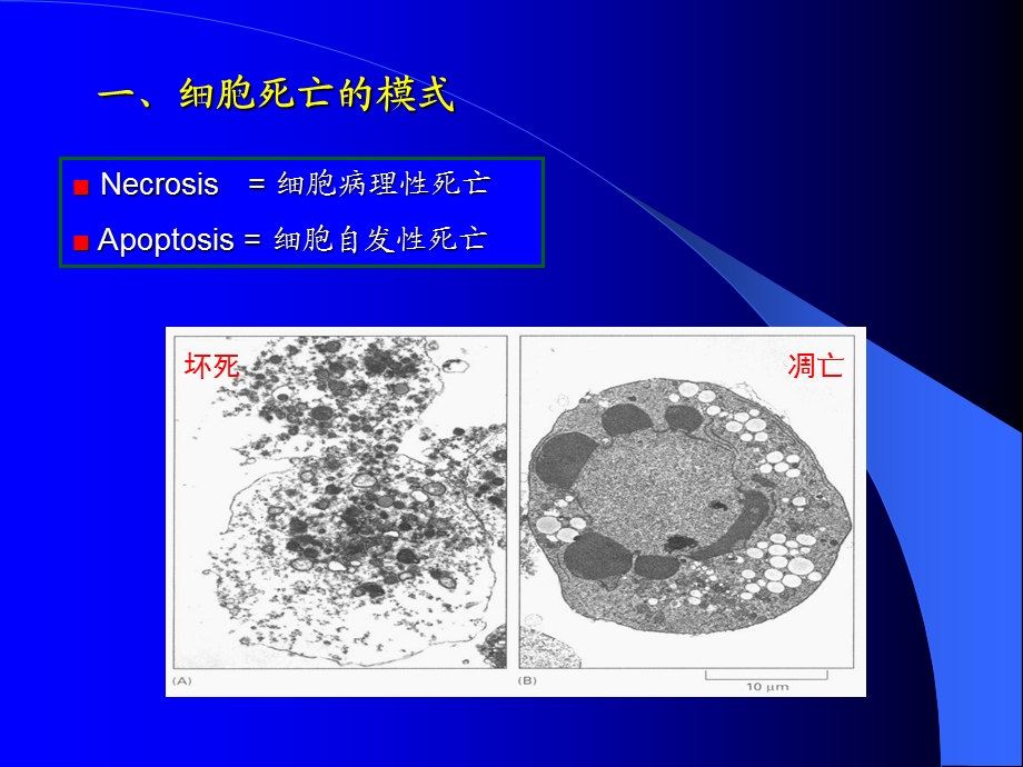 第八章 细胞凋亡 ppt课件.ppt_第3页