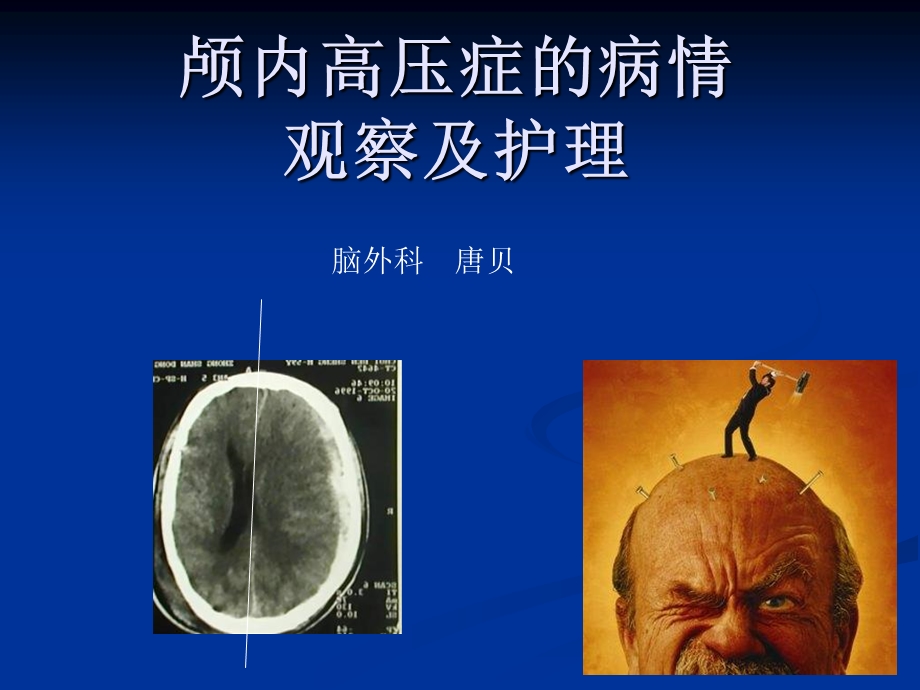 唐贝颅内压增高病人的护理.ppt_第1页