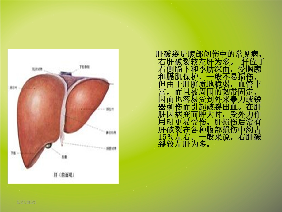 清爽绿色模版(4：3)肝破裂的抢救与配合.ppt_第3页