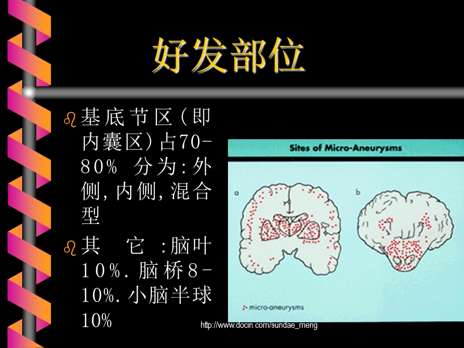 【大学课件】脑出血教案PPT.ppt_第3页