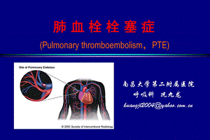 医学ppt内科学肺栓塞教案.ppt