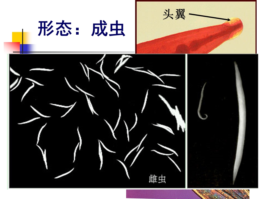 周蛲虫广州管圆线虫丝虫旋毛虫ppt课件.ppt_第3页