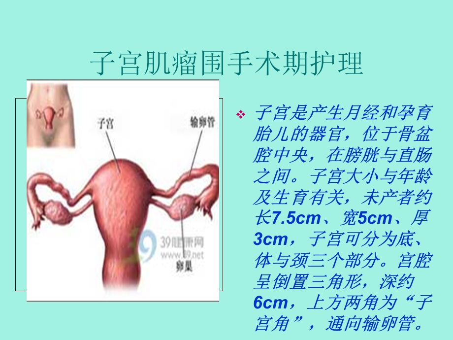 子宫肌瘤围手术期护理.ppt_第3页